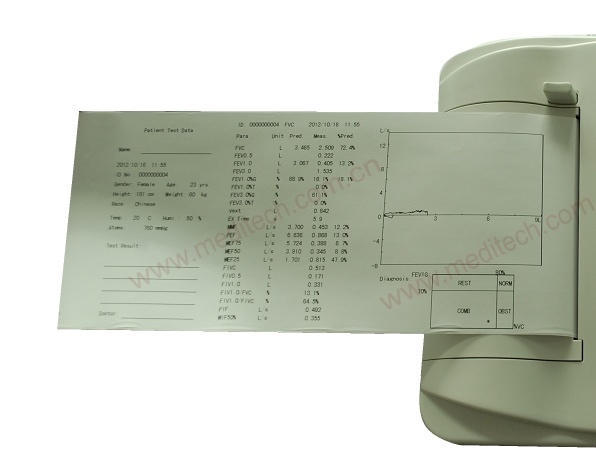 SpirOx pro Spirometer printing report