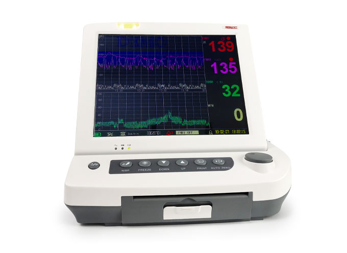 ما هو جهاز مراقبة الجنين (Fetal Monitor)