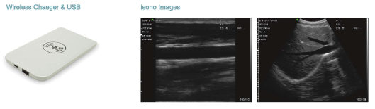 wireless ultrasound scanner