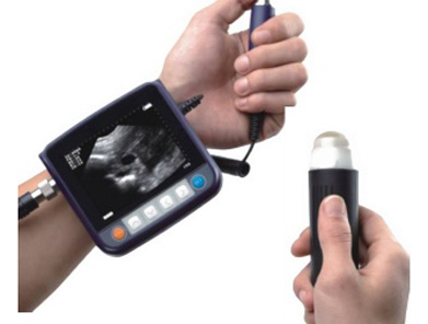 miniScan ultrasound